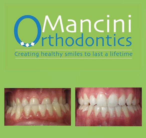 Mancini Orthodontics gallery photo 5